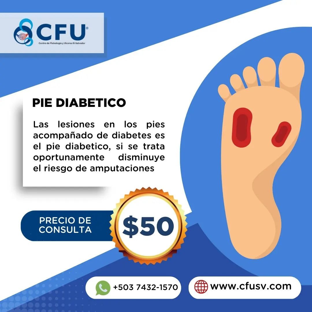 Tratamiento Para Pie Diabético En San Salvador